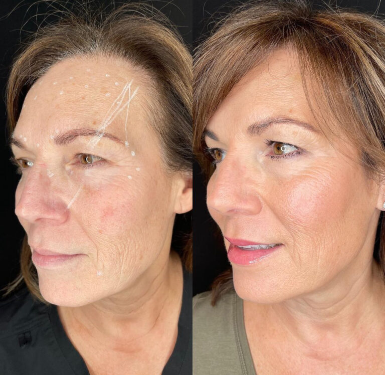 Advanced Anti-Aging Treatments at Aesthetic Nirvana